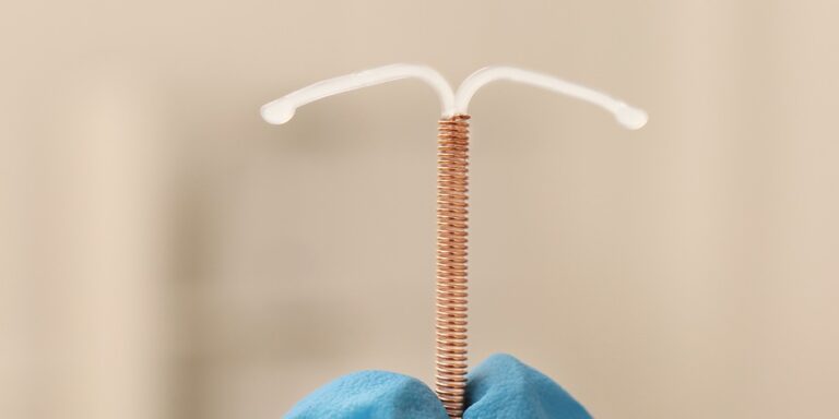 DIU: o que é, tipos, vantagens e cuidados