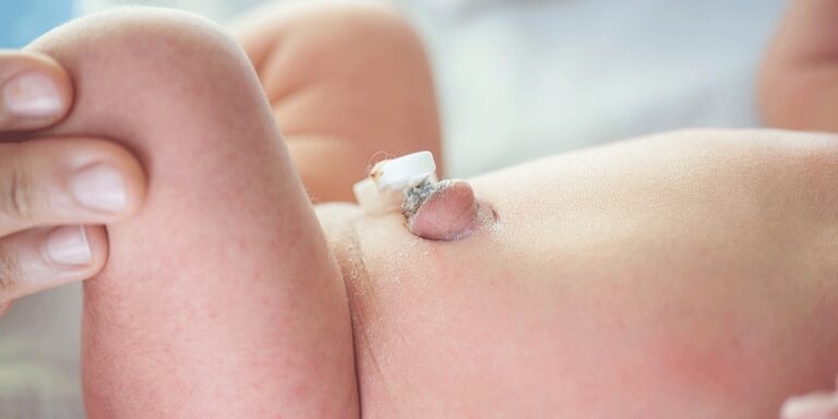 Tire suas dúvidas sobre o cordão umbilical