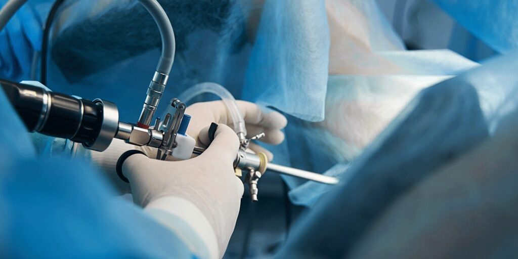 O que é histeroscopia e como é realizada a cirurgia?